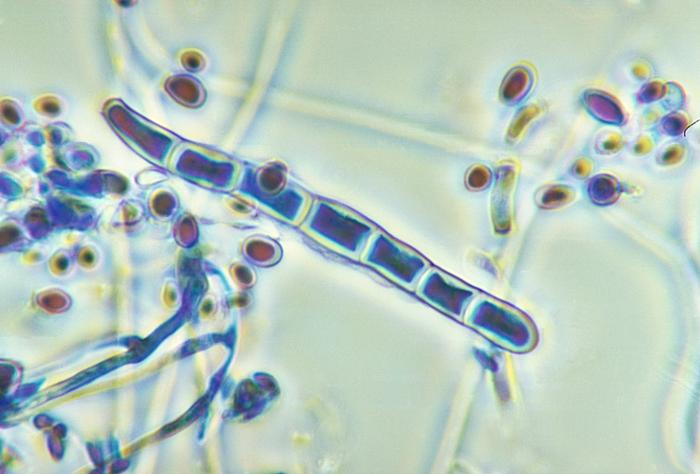 Trichophyton mentagrophytes detail pod mikroskopem