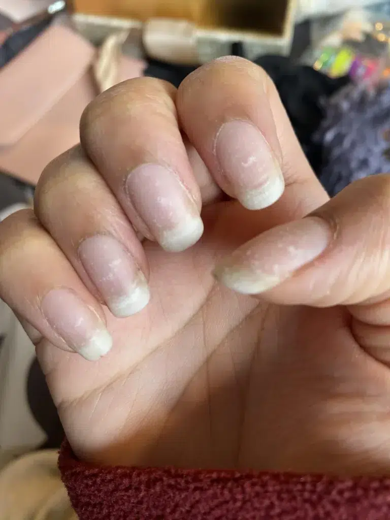 Nepovedená manikúra – přírodní nehty oslabené a zlomené po aplikaci gelu